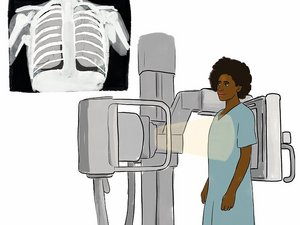 Eine Frau steht in einem Röntgengerät. Auf einem Bildschirm ist ihr Brustkorb als Skelett zu sehen.